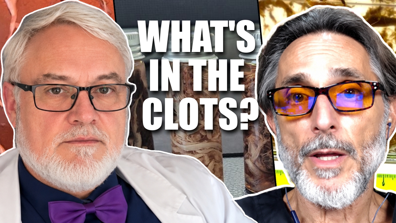 a-comprehensive-overview-of-current-“calamari”-clots-research