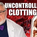 dr.-bruce-rapley:-mechanisms-&-dangers-of-anomalous-clots