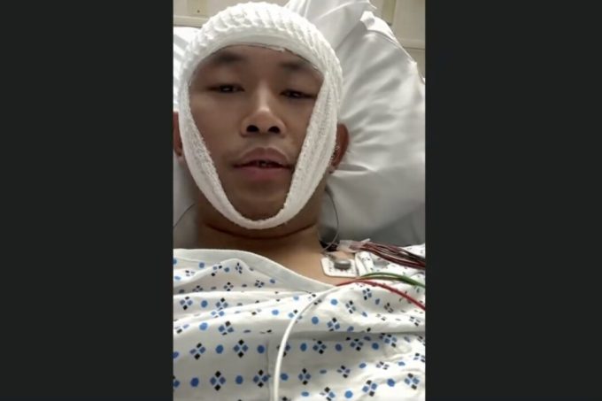 repeatedly-targeted-anti-ccp-activist-beaten-unconscious-in-new-york