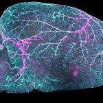 cerebral-small-vessel-disease:-new-treatment-possibilities-for-the-little-known-condition-affecting-millions-of-people