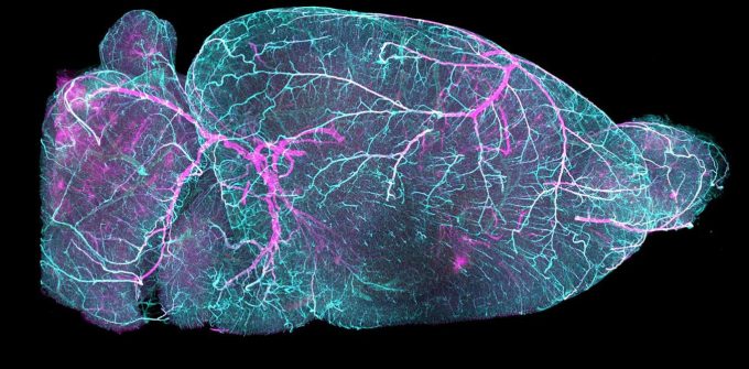 cerebral-small-vessel-disease:-new-treatment-possibilities-for-the-little-known-condition-affecting-millions-of-people