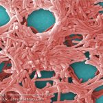 source-of-toronto’s-legionnaires-outbreak-traced-to-cooling-tower,-public-health-says