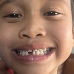 food-allergy-canada-calls-for-laws-forcing-schools-to-stock-epinephrine-devices
